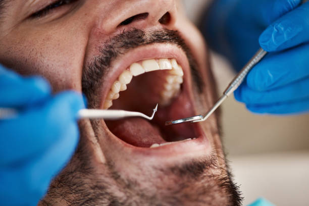 Best Broken or Chipped Tooth Repair in Lemoyne, PA