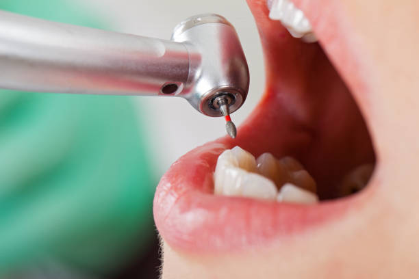 Best Emergency Treatment for Oral Infections in Lemoyne, PA